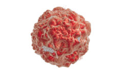 tumor cell