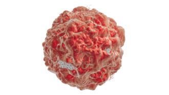 tumor cell
