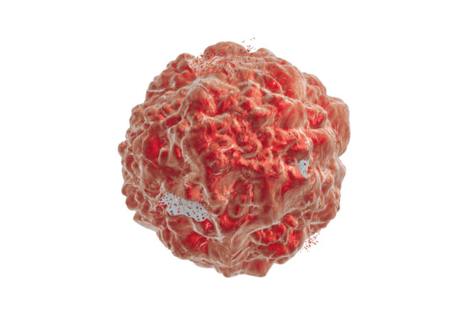 tumor cell