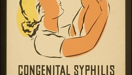 CDC Congenital Syphilis