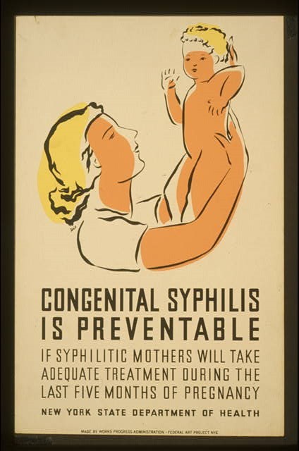 CDC Congenital Syphilis