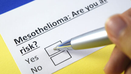 Mesothelioma Risk