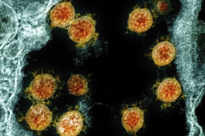 A microscopic image reveals the round, spiky particles of the coronavirus, reminiscent of its first detection and subsequent challenges faced by Hong Kong.