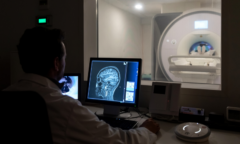 image of brain scan on computer