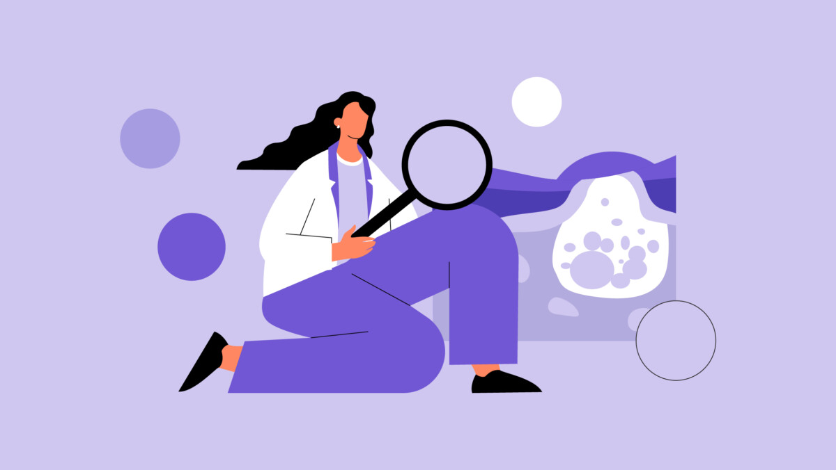 Illustration of a person in a lab coat kneeling and examining a sample with a magnifying glass, highlighting dermatologist expertise against a light purple background.