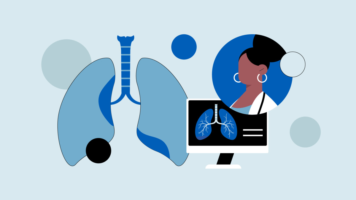 Illustration of lungs and trachea, a computer monitor displaying a lung image, with a pulmonologist reviewing results—perfect for articles on pulmonologist side gigs or remote healthcare roles.
