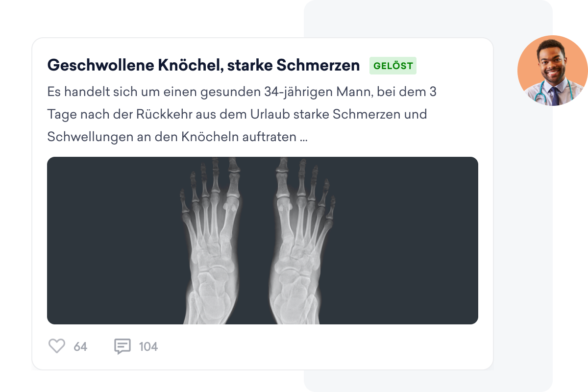 Beitrag in einem medizinischen Forum auf einem sozialen Netzwerk für Ärzte über einen Mann mit geschwollenen Knöcheln, mit einer Röntgenaufnahme des Fußes und dem Profilbild eines Arztes.