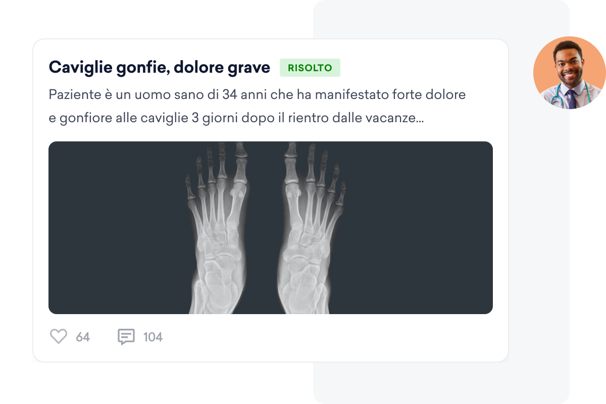 Radiografia di entrambi i piedi per un caso clinico riguardante un uomo di 34 anni con caviglie gonfie e doloranti, condivisa su un social network da “per medici”.